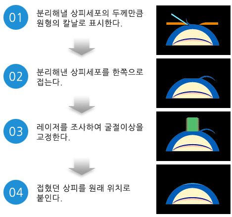 군산안과 