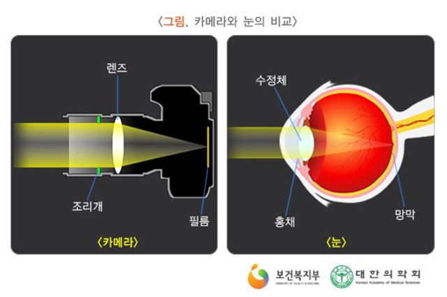 군산안과 