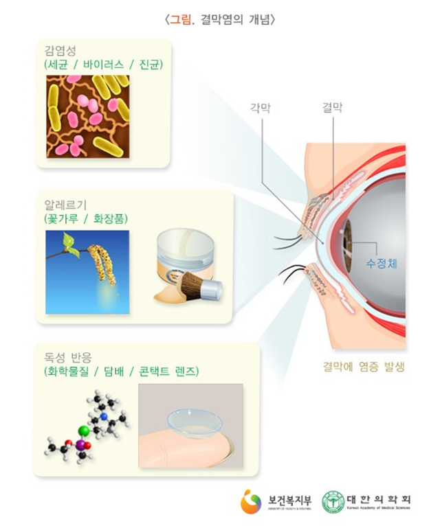 군산안과 